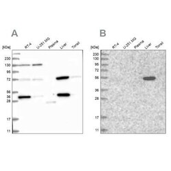 UGP2 Antibody, Novus Biologicals 0.1 mL | Buy Online | Novus Biologicals | Fisher Scientific