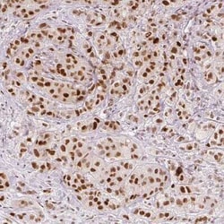ZNF703 Antibody (CL0654), Novus Biologicals 25 &mu;L, Unconjugated:Antibodies,