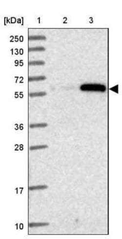 ZSCAN5 Antibody, Novus Biologicals 0.1 mL, Unconjugated:Antibodies, Polyclonal