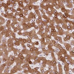 alpha 1-Acid Glycoprotein Antibody, Novus Biologicals 0.1 mL, Unconjugated:Antibodies,