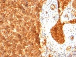 alpha-Fetoprotein/AFP Antibody (SPM334) - IHC-Prediluted, Novus Biologicals