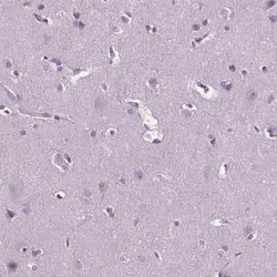 carabin Antibody, Novus Biologicals 0.1 mL | Buy Online | Novus Biologicals | Fisher Scientific