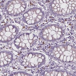 CD84/SLAMF5 Antibody, Novus Biologicals 25 &mu;L, Unconjugated:Antibodies,