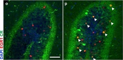 Calretinin Antibody, Novus Biologicals:Antibodies:Primary Antibodies