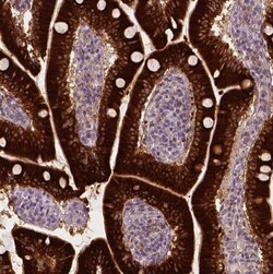 Apolipoprotein A-IV/ApoA4 Antibody (CL0468), Novus Biologicals 0.1 mL,