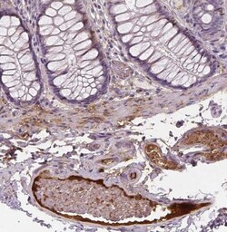 Apolipoprotein A-IV/ApoA4 Antibody (CL0468), Novus Biologicals 0.1 mL,