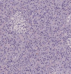 Apolipoprotein A-IV/ApoA4 Antibody (CL0468), Novus Biologicals 0.1 mL,