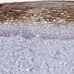 12-Lipoxygenase Rabbit anti-Human, Polyclonal, Novus Biologicals:Antibodies:Primary