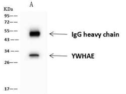 14-3-3 epsilon Antibody, Novus Biologicals:Anticuerpos:Anticuerpos primarios