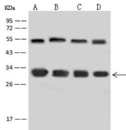 14-3-3 epsilon Antibody, Novus Biologicals:Anticuerpos:Anticuerpos primarios
