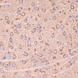 14-3-3 gamma Rabbit anti-Human, Mouse, Rat, Clone: 5R4Q4, Novus Biologicals:Antibodies:Primary