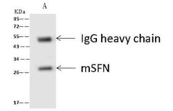 14-3-3 sigma/Stratifin Antibody, Novus Biologicals:Anticorps:Anticorps