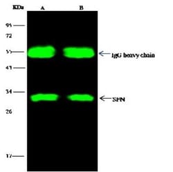 14-3-3 sigma/Stratifin Antibody, Novus Biologicals:Antibodies:Primary Antibodies