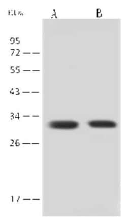 14-3-3 sigma/Stratifin Antibody, Novus Biologicals:Anticorps:Anticorps
