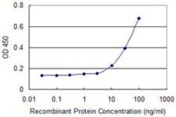 15-Lipoxygenase 2 Antibody (4A7), Novus Biologicals 0.1 mg | Buy Online | Novus Biologicals | Fisher Scientific