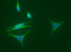 15-PGDH/HPGD Rabbit anti-Human, Clone: 16, Novus Biologicals 100 &mu;g;