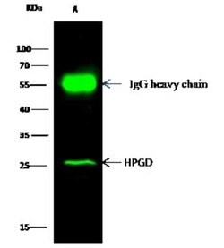 15-PGDH/HPGD Antibody, Novus Biologicals 100 &mu;g, Unconjugated:Anticorps,