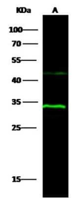 15-PGDH/HPGD Antibody, Novus Biologicals 100 &mu;g, Unconjugated:Anticorps,