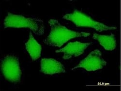 26S proteasome subunit 9 Antibody, Novus Biologicals 0.05 mg | Buy Online | Novus Biologicals | Fisher Scientific