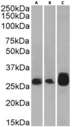 4-1BB/TNFRSF9/CD137 Rabbit anti-Human, Clone: 4B4-1-1, Novus Biologicals:Antibodies:Primary