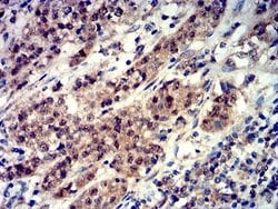 4EBP1 Antibody (1E2E7) - BSA Free, Novus Biologicals 0.1 ml; Unconjugated:Antibodies,