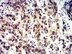 4EBP1 Antibody (2D1G11) - BSA Free, Novus Biologicals:Antibodies:Primary