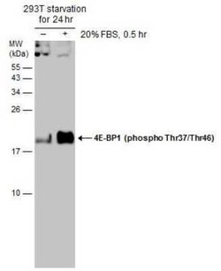 4EBP1, p Thr46, p Thr37 Antibody, Novus Biologicals 100 μg; Unconjugated:Antibodies,