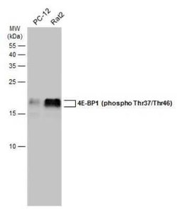 4EBP1, p Thr46, p Thr37 Antibody, Novus Biologicals 100 μg; Unconjugated:Antibodies,