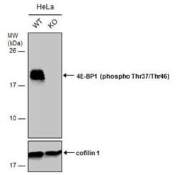 4EBP1, p Thr46, p Thr37 Antibody, Novus Biologicals 100 μg; Unconjugated:Antibodies,