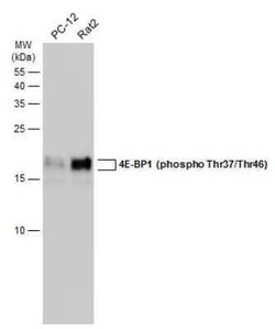 4EBP1, p Thr46, p Thr37 Antibody, Novus Biologicals 100 &mu;g | Buy Online | Novus Biologicals | Fisher Scientific