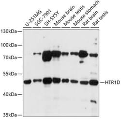 5-HT1D Antibody - Azide and BSA Free, Novus Biologicals 0.02 mL | Buy Online | Novus Biologicals | Fisher Scientific