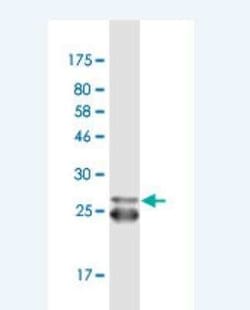 5-HT2B Antibody (4A4), Novus Biologicals 100 &mu;g;, Unconjugated:Antibodies,