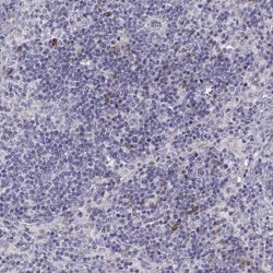 5-HT3A Antibody, Novus Biologicals:Antibodies:Primary Antibodies