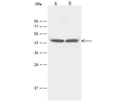 5-HT4 Antibody, Novus Biologicals 100 &mu;g; Unconjugated:Antibodies, Polyclonal