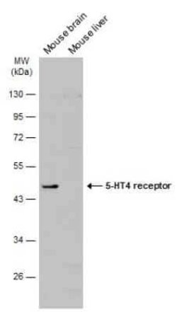 5-HT4 Antibody, Novus Biologicals 100 &mu;g | Buy Online | Novus Biologicals | Fisher Scientific