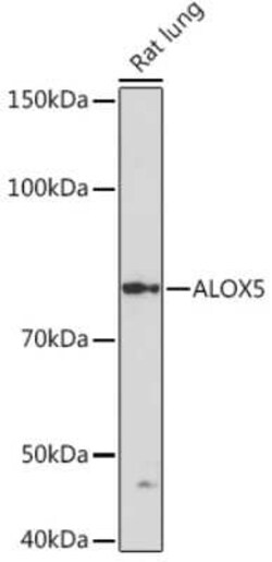5-Lipoxygenase Rabbit anti-Human, Mouse, Rat, Clone: 5C5Z2, Novus Biologicals