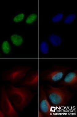 53BP1 Antibody (1285C) - Azide and BSA Free, Novus Biologicals 0.1 mg;