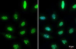 53BP1 Antibody (HL275), Novus Biologicals 100 &mu;g | Buy Online | Novus Biologicals | Fisher Scientific