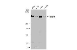 53BP1 Antibody (HL275), Novus Biologicals 100 &mu;g | Buy Online | Novus Biologicals | Fisher Scientific