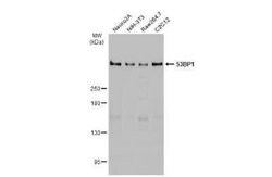53BP1 Antibody (HL275), Novus Biologicals 100 &mu;g | Buy Online | Novus Biologicals | Fisher Scientific