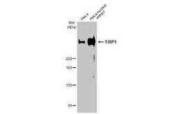 53BP1 Antibody (HL275), Novus Biologicals 100 &mu;g | Buy Online | Novus Biologicals | Fisher Scientific