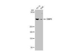 53BP1 Antibody (HL275), Novus Biologicals 100 &mu;g | Buy Online | Novus Biologicals | Fisher Scientific