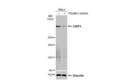 53BP1 Antibody (HL275), Novus Biologicals 100 &mu;g | Buy Online | Novus Biologicals | Fisher Scientific