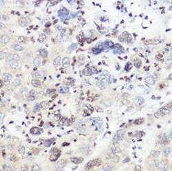 6 Phosphofructo 2 Kinase Rabbit anti-Human, Mouse, Rat, Clone: 7X2H3, Novus