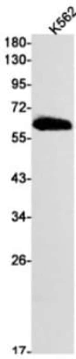 6 Phosphofructo 2 Kinase Antibody (S08-7A4), Novus Biologicals:Antibodies:Primary