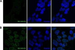A. aeolicus BPL/BioID2 Antibody (SS 3A5-E2) - BSA Free, Novus Biologicals:Antibodies:Primary