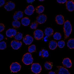 A20/TNFAIP3 Antibody, Novus Biologicals 25ul; Unconjugated:Antibodies,