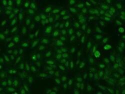 A2BP1 Antibody, Novus Biologicals 100 &mu;g, Unconjugated:Anticorps, Polyclonal