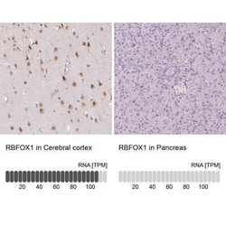 A2BP1 Antibody, Novus Biologicals 0.1 mL; Unconjugated:Antibodies, Polyclonal