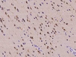 A2BP1 Antibody, Novus Biologicals 100 &mu;g, Unconjugated:Anticorps, Polyclonal